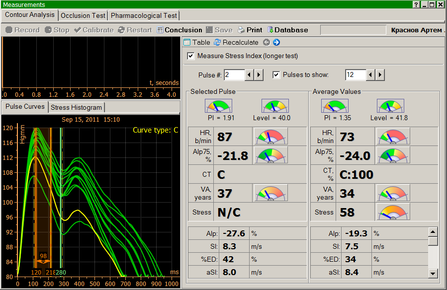 Angioscan: How it diagnoses early cardio-vascular changes