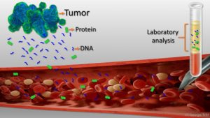 Liquid biopsy.Circulating tumour cells, a non invasive cancer detection test.
