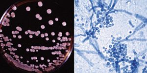 Undiagnosed latent infection can lead to cancer