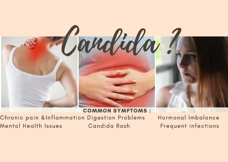 Do you have candida overgrowth?