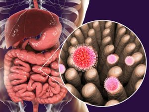 Is it Candida or Parasites in your gut, making you sick - Freedom Age