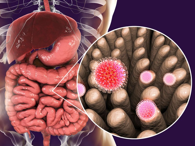 Is it Candida or Parasites in your gut, making you sick?