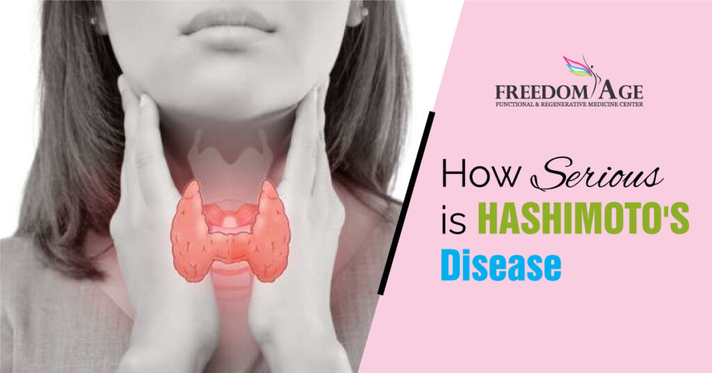 How Serious is Hashimoto’s Disease Clinic in Gurgaon
